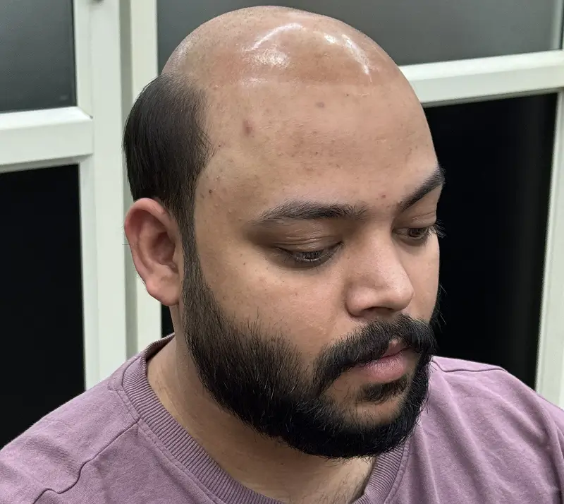 Rectangle 66 (2) Rectangle 66 (2)